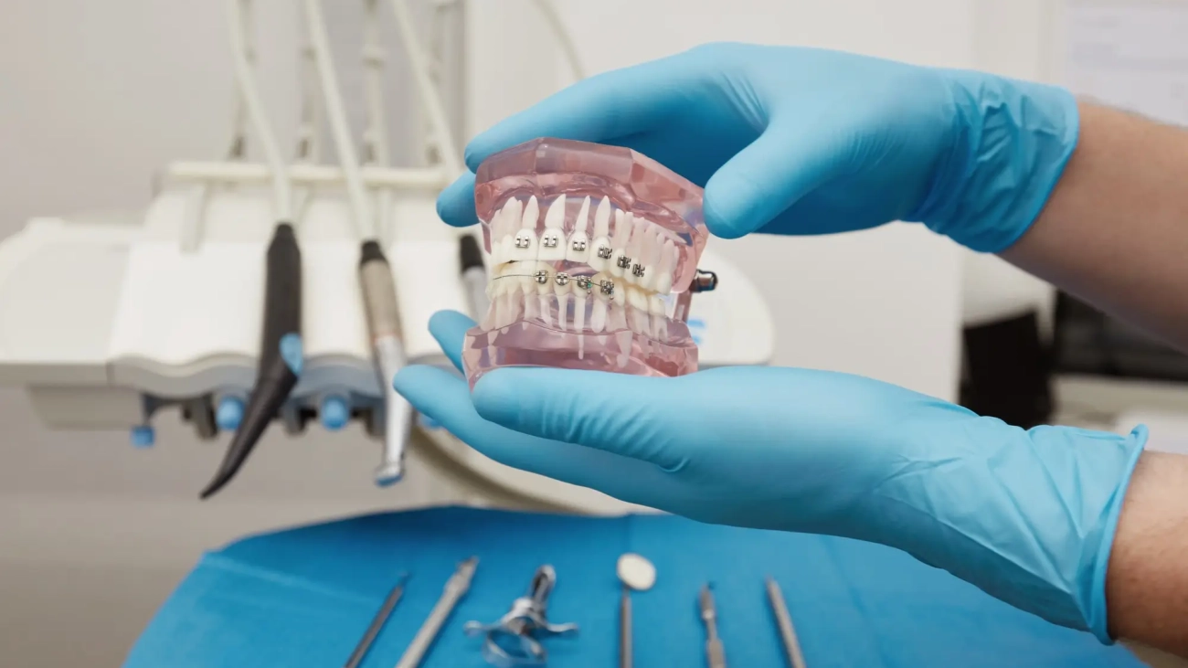 آشنایی با انواع تجهیزات ارتودنسی