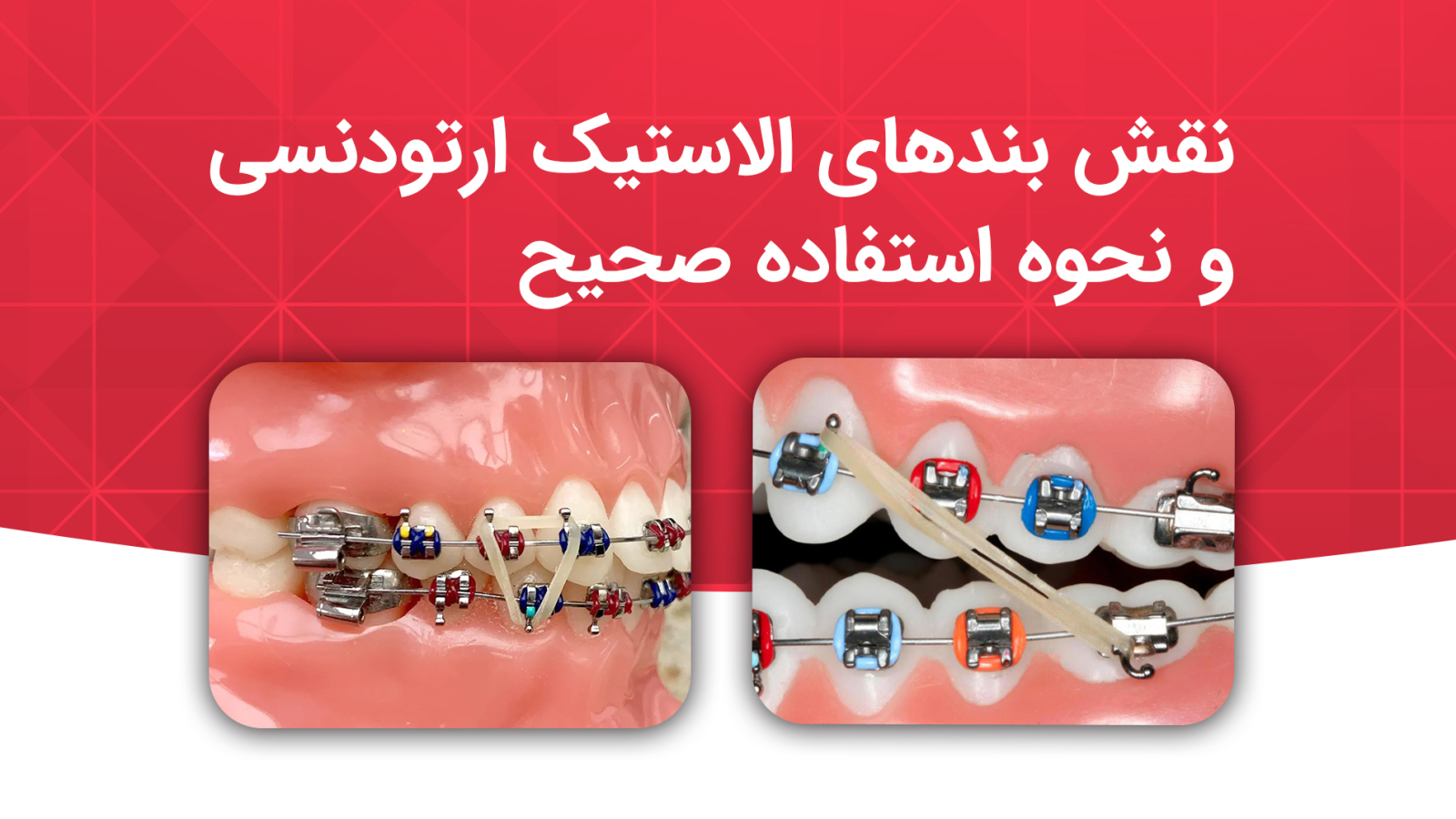 naqsh elastic