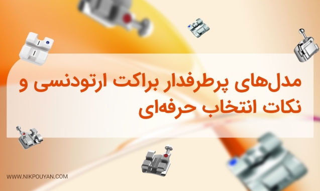 مدلهای پرطرفدار براکت ارتودنسی - انتخاب براکت ارتودنسی