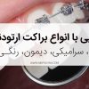 انواع براکت ار‌تودنسی