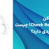 دهان باز کن