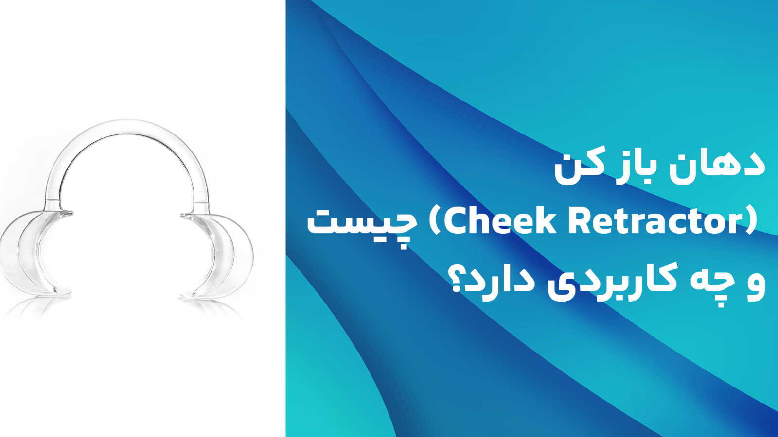 دهان باز کن