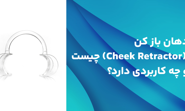 دهان باز کن