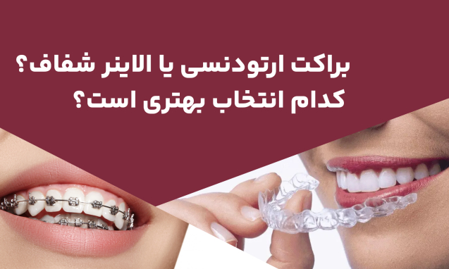 1772623374_ORTHO-ALIGNER