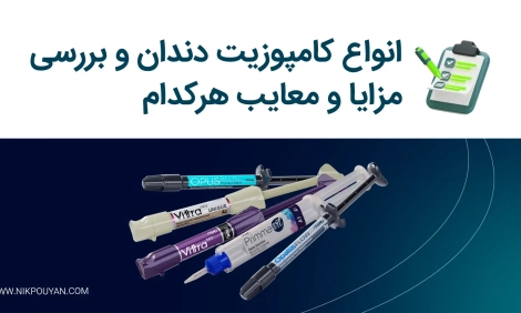 انتخاب کامپوزیت مناسب
