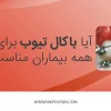 آیا باکال تیوب برای همه بیماران مناسب است؟