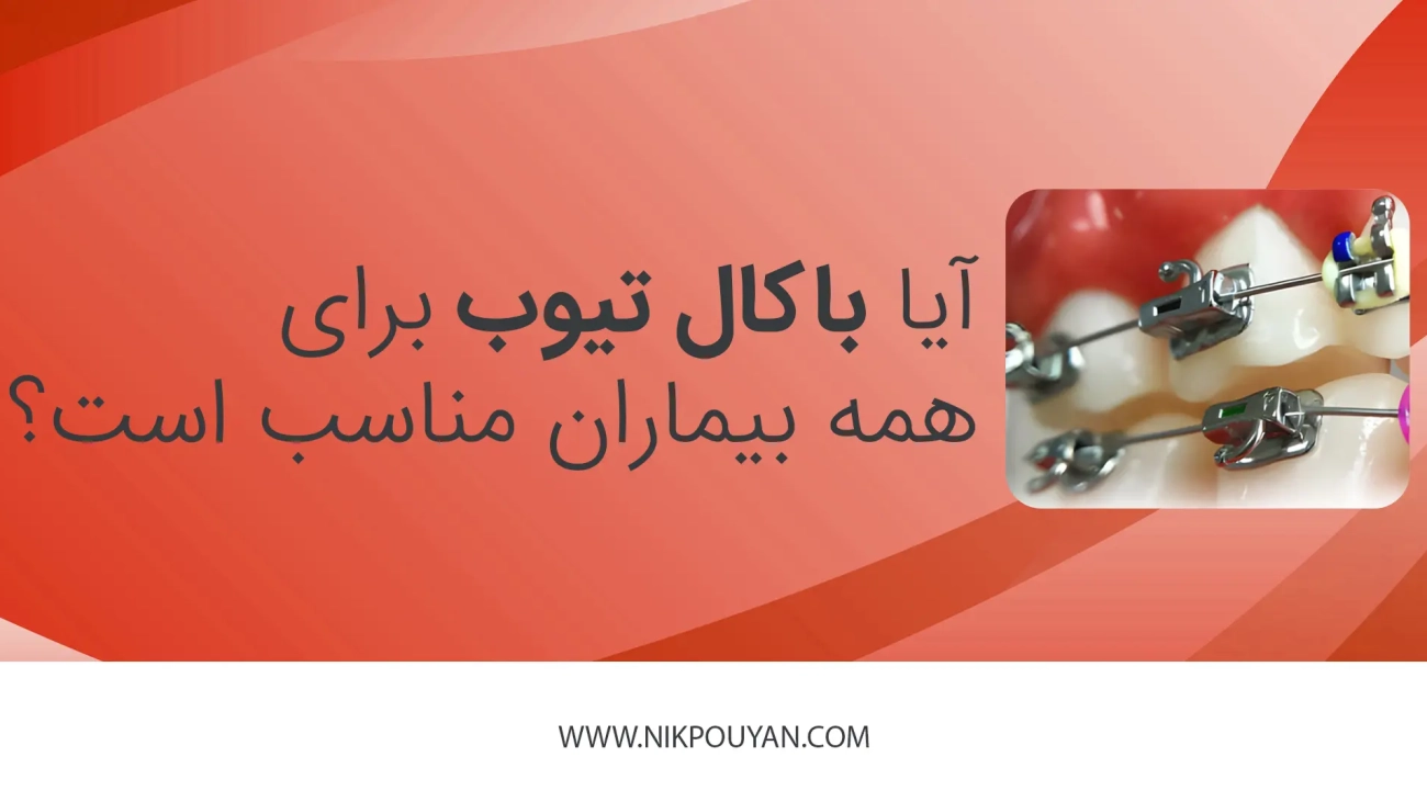 آیا باکال تیوب برای همه بیماران مناسب است؟