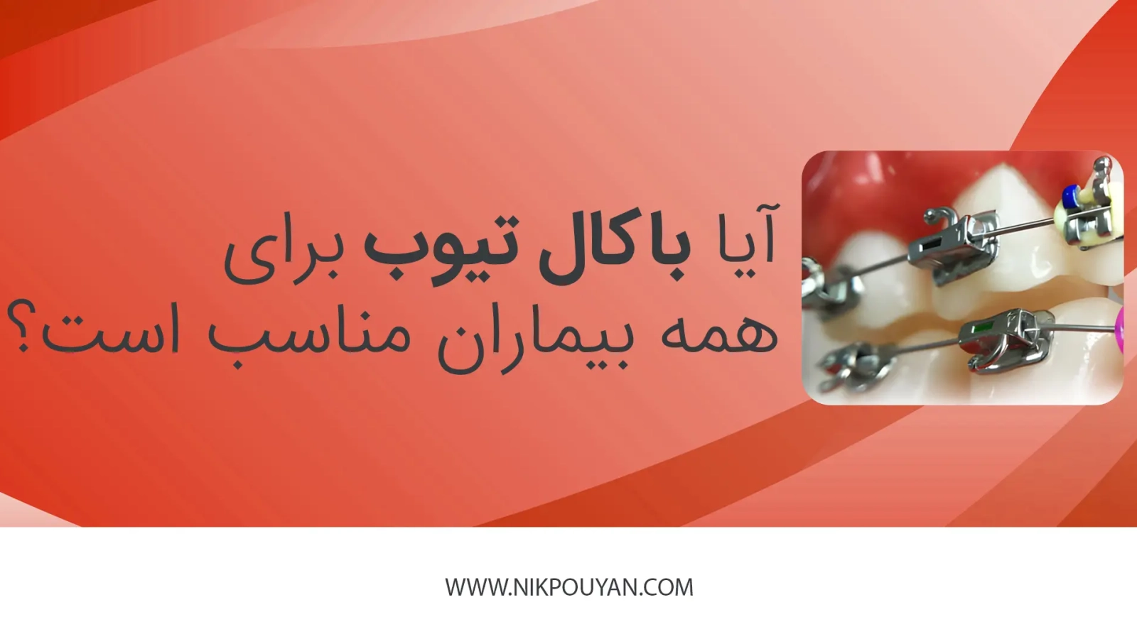 آیا باکال تیوب برای همه بیماران مناسب است؟
