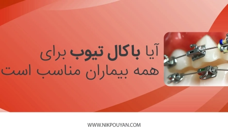 آیا باکال تیوب برای همه بیماران مناسب است؟