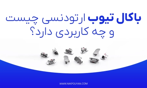 باکال تیوب ارتودنسی چیست؟
