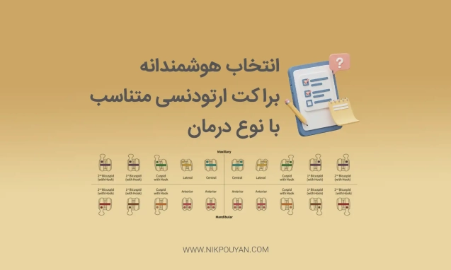 انتخاب براکت ارتودنسی