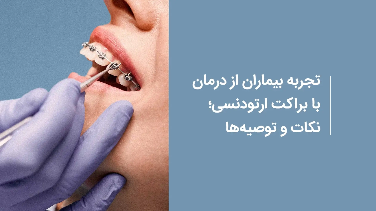 تجربه بیماران از درمان با براکت ارتودنسی