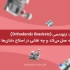 عملکرد براکت ارتودنسی