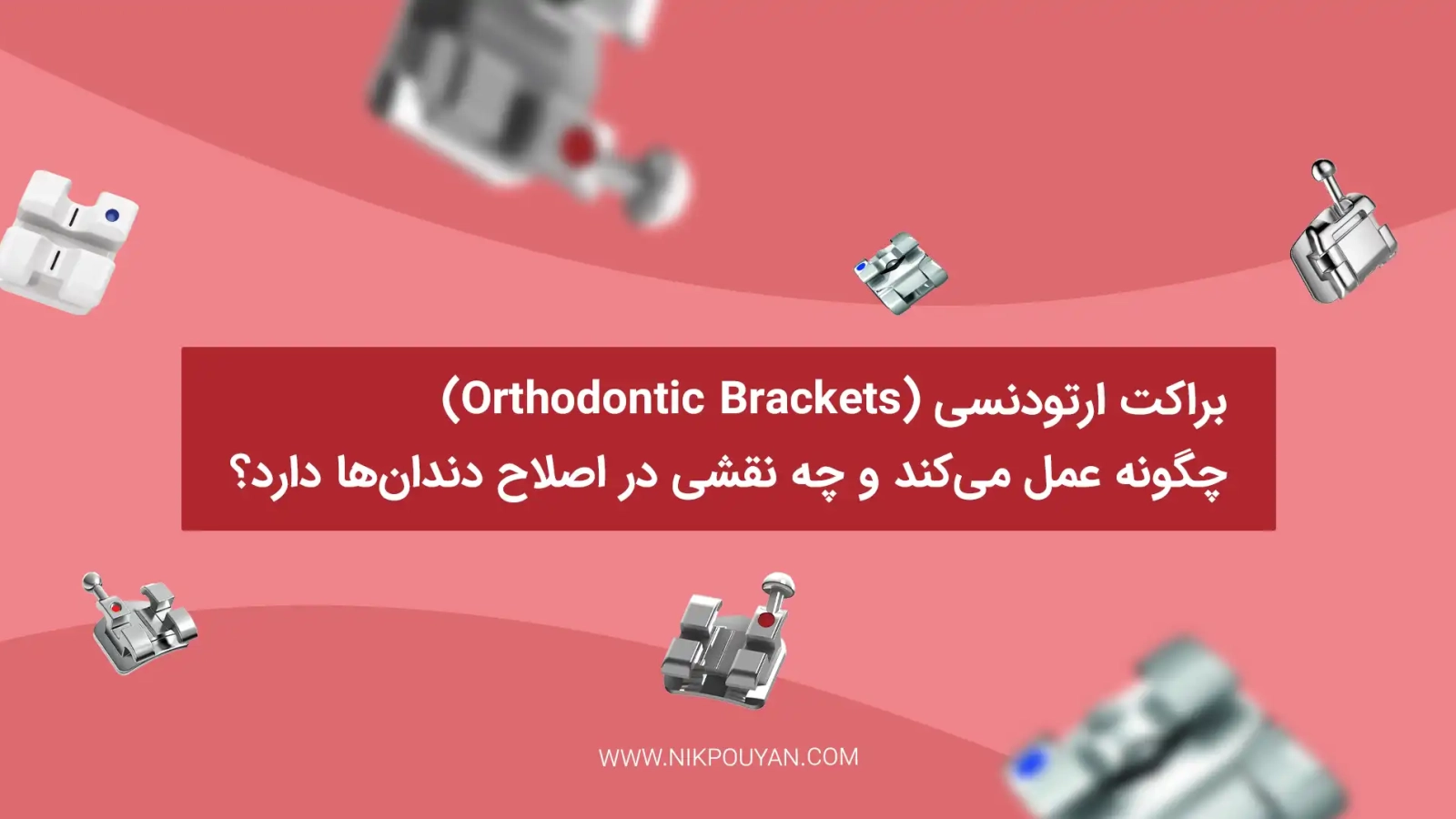 عملکرد براکت ارتودنسی