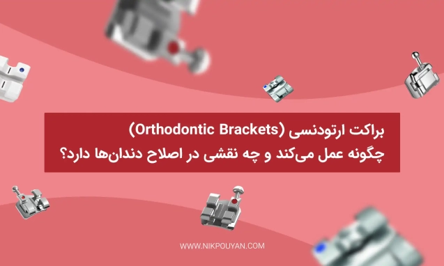 عملکرد براکت ارتودنسی