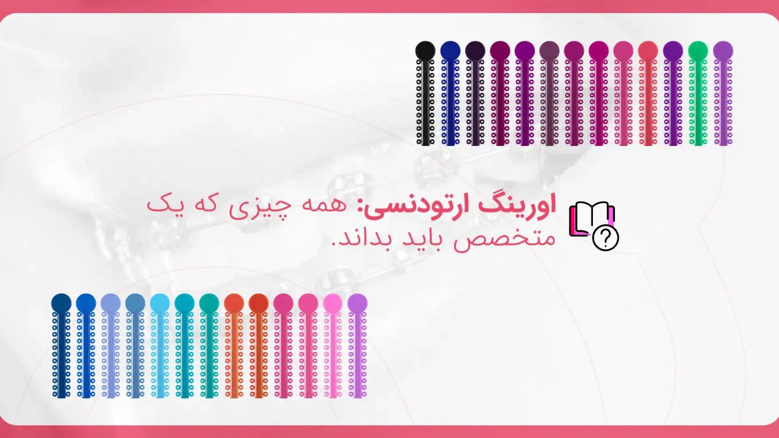 همه چیز درباره اورینگ ارتودنسی