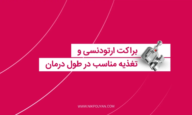 تغذیه مناسب با براکت ارتودنسی