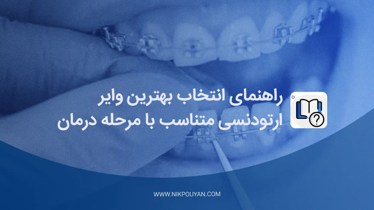 بهترین وایر ارتودنسی