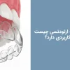 شیت ارتودنسی چیست