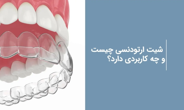 شیت ارتودنسی چیست